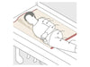 Support Human Care Alpha Turning Sheet Gentle, Safe, and Easy Lateral Repositioning for Pain-Sensitive and Heavy Clients