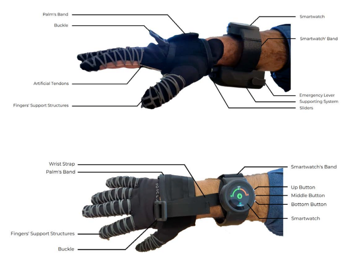 Neuro Rehab Recovery Nuada Glove Only Smart Powered Assistive Glove for Hand Rehabilitation, Grip Support, and Daily Living Assistance  Features